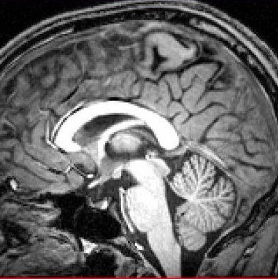 My brain